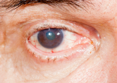 視力加盟,視力連鎖,視力保健